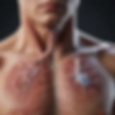 Impact of Bacterial Pneumonia on the Respiratory System Diagram illustrating respiratory system affected by pneumonia.
