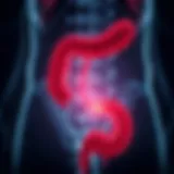 Illustration of an inflamed colon Inflamed colon illustration