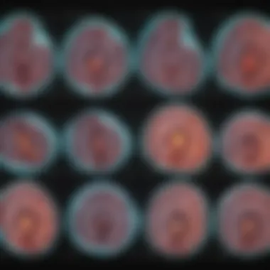 Comparison of Imaging Modalities for Ovarian Cancer Detection Comparison chart of CT scans versus other imaging modalities in detecting ovarian cancer.