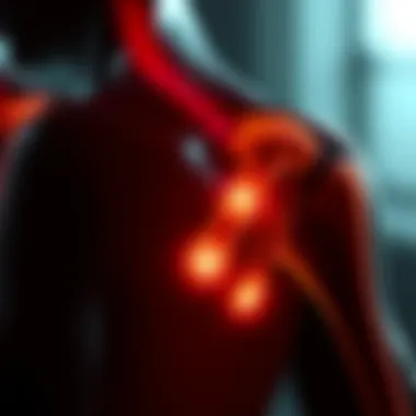 Understanding Shoulder Pain Locations Illustration of a shoulder highlighting pain areas