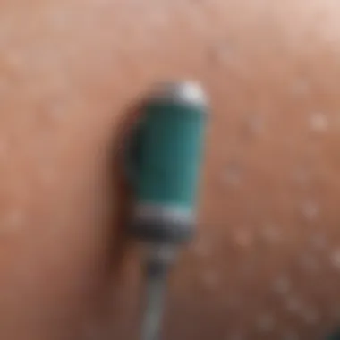 Close-up of a derma roller highlighting its needle structure