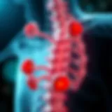 Illustration of vertebral tumor classification.
