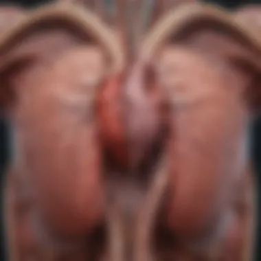 Schematic representation of ventricular septal defect anatomy