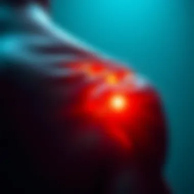 Overview of various treatment options for shoulder impingement