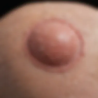 Molluscum Contagiosum Lesions Close-up view of molluscum contagiosum lesions on skin
