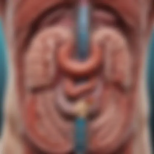 Illustration of the gastrointestinal tract highlighting ulcerations