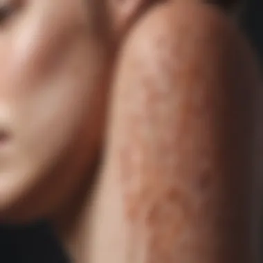 Diagram showing types of psoriasis