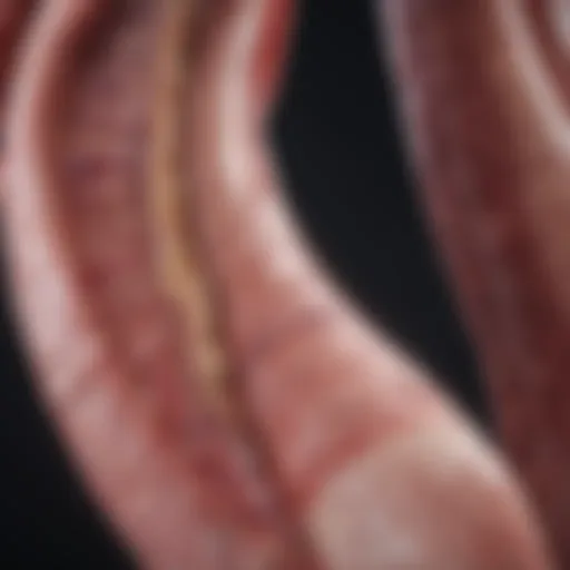 Detailed illustration of anal cancer progression stages