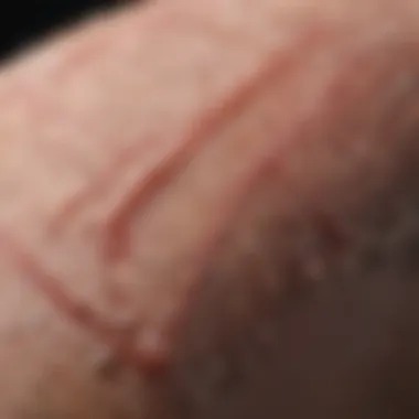 Wound Healing Process with Super Glue Stitches Visual representation of wound healing with super glue