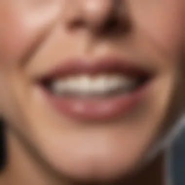 Aesthetic Enhancement: Natural vs Laminated A comparison between natural teeth and laminated teeth highlighting aesthetic enhancement