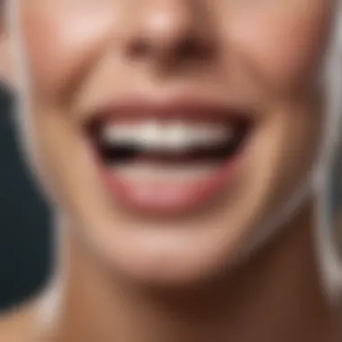 An illustration demonstrating the layering technique in teeth lamination