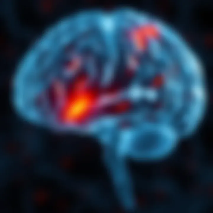 Neuroscience of Sleep and Mood Disorders A brain illustration highlighting areas affected by depression and sleep