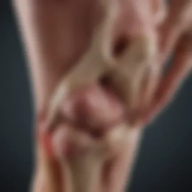 Illustration depicting common tibial tendon injuries