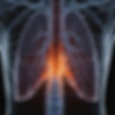 CT scan image showcasing a pulmonary embolism clearly marked for educational purposes