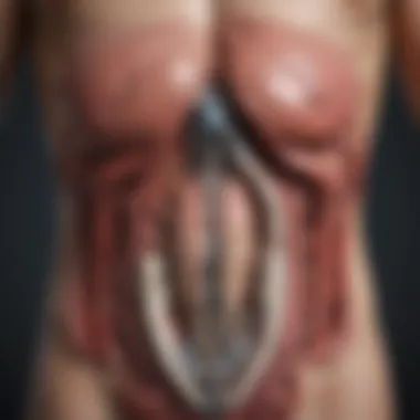Diagram illustrating duodenal switch anatomy