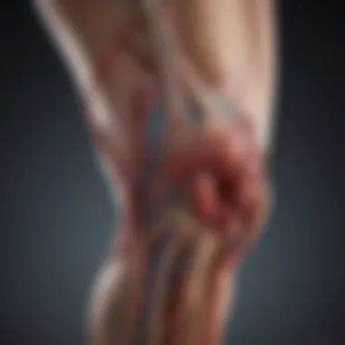 Vascular Circulation Around the Knee Diagram illustrating vascular circulation around the knee