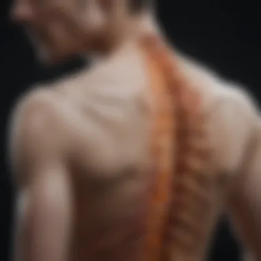 Visualization of Lumbar Kyphosis Visualization of lumbar kyphosis in a spine model