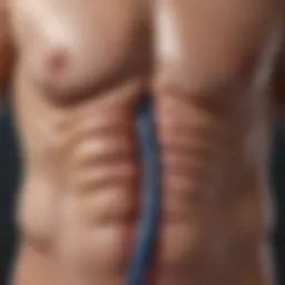 Illustration of muscle fibers affected by surgery