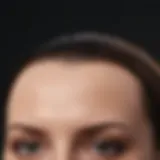 Illustration of a widow's peak hairline