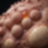 Illustration of various types of cysts